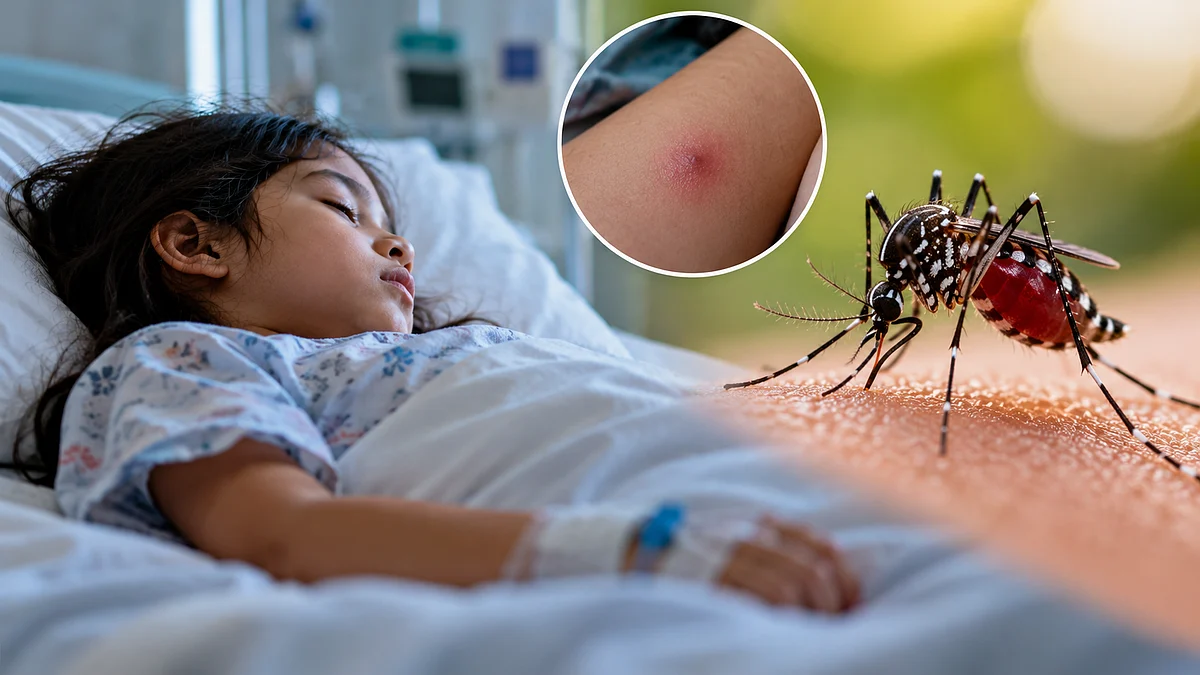 Pune Records 2,291 Dengue Cases In 10 Months; PMC Steps Up Prevention Drive