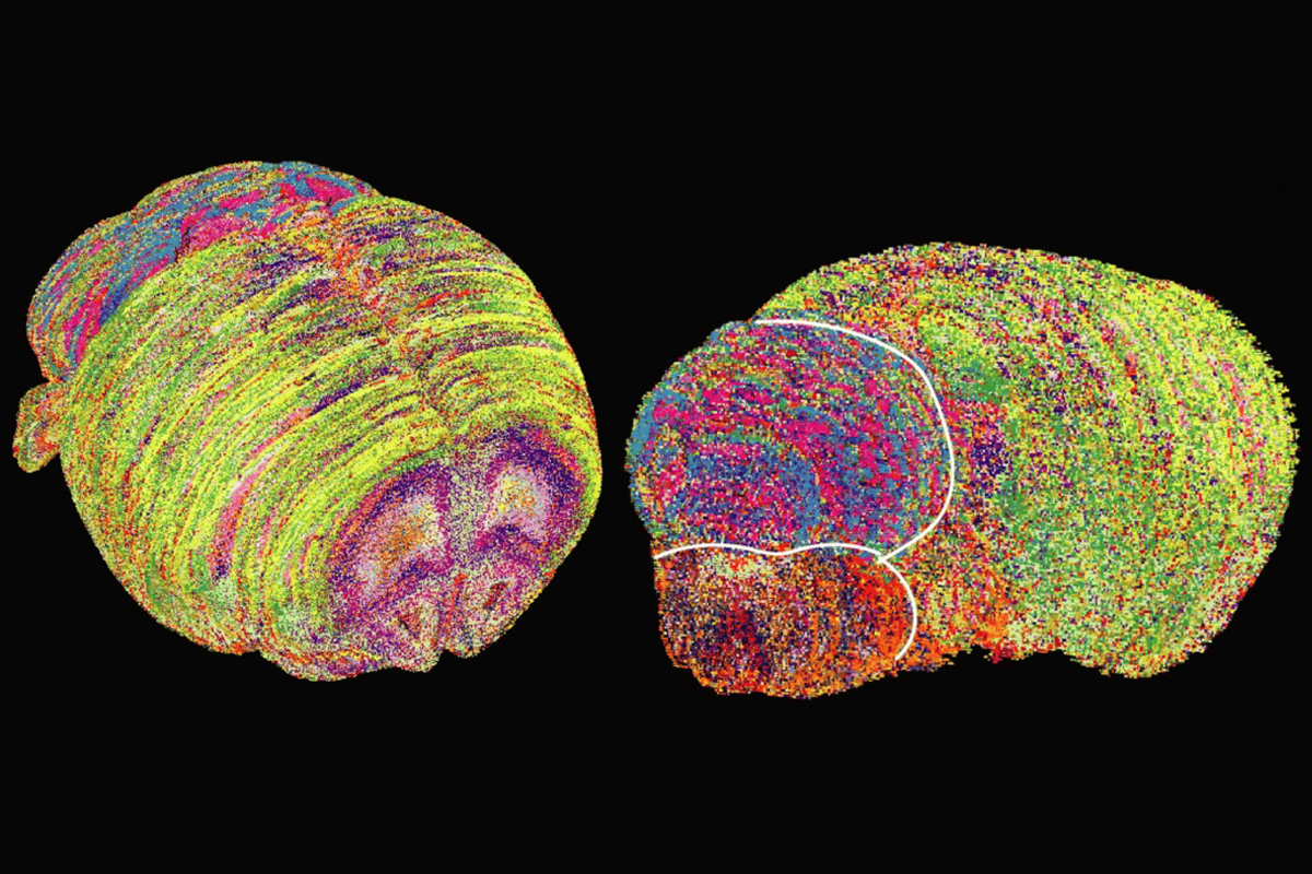 Lipids enter brain mapping limelight