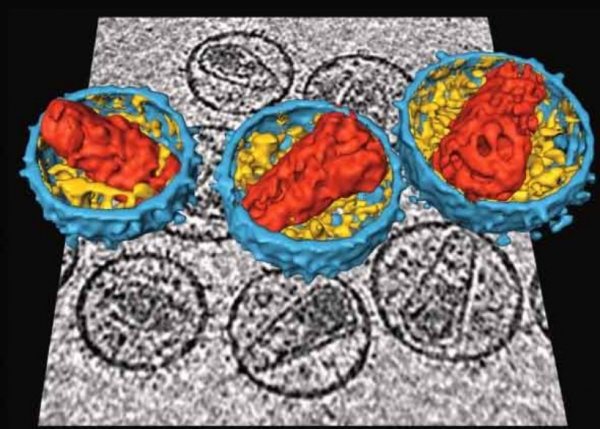 A new study suggests HIV prevention has stalled. But there may be a silver lining