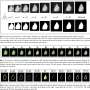 Researchers identify the tissue surrounding breast microcalcifications as a key source of diagnostic information