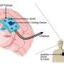 3D-printed implant prototype combines brain activity recording with targeted cooling