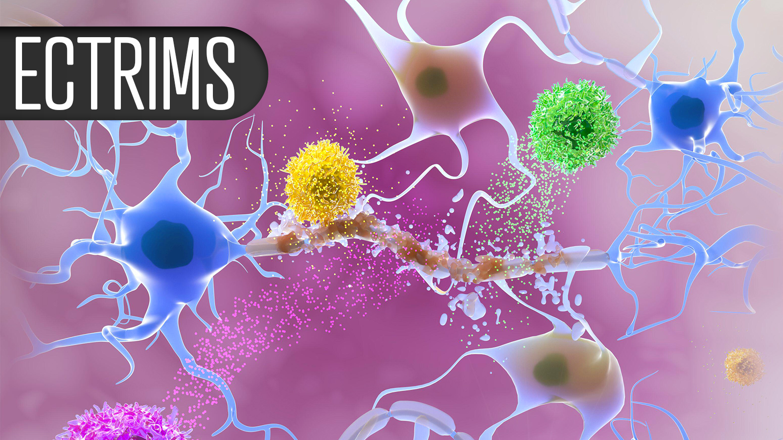 Fenebrutinib May Curb Chronic Active Lesions in Multiple Sclerosis