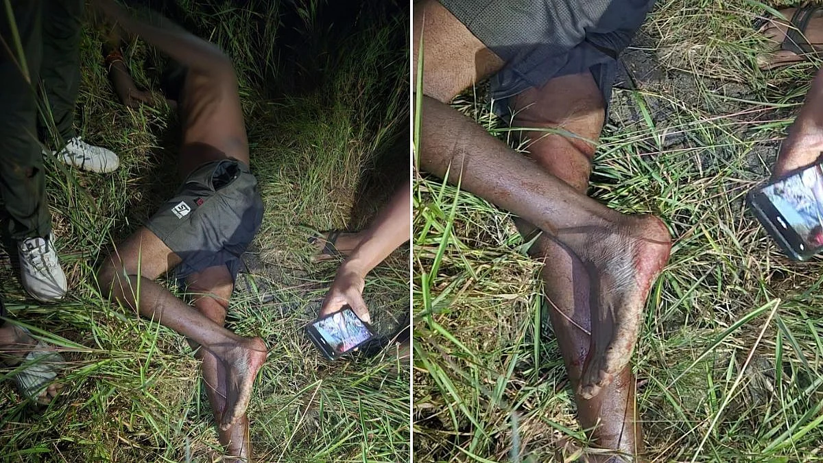 Palghar: Injured Man Mentions Leopard Attack In Umroli; Forest Officials Find No Pugmarks, Probe Underway