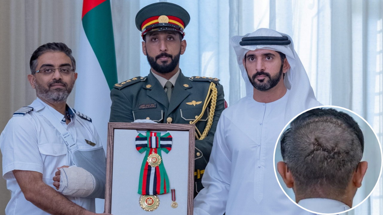 'Battle scars': Massive stitches on Capt Smit's head draw attention as UAE honours him