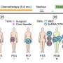 Personalized ovarian cancer vaccines spark immunity in phase 1 trial