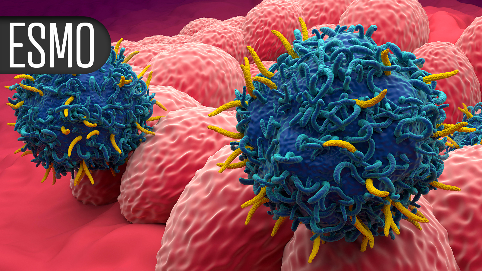Another Win for Novel Drug, This Time in EGFR-Mutated Lung Cancer