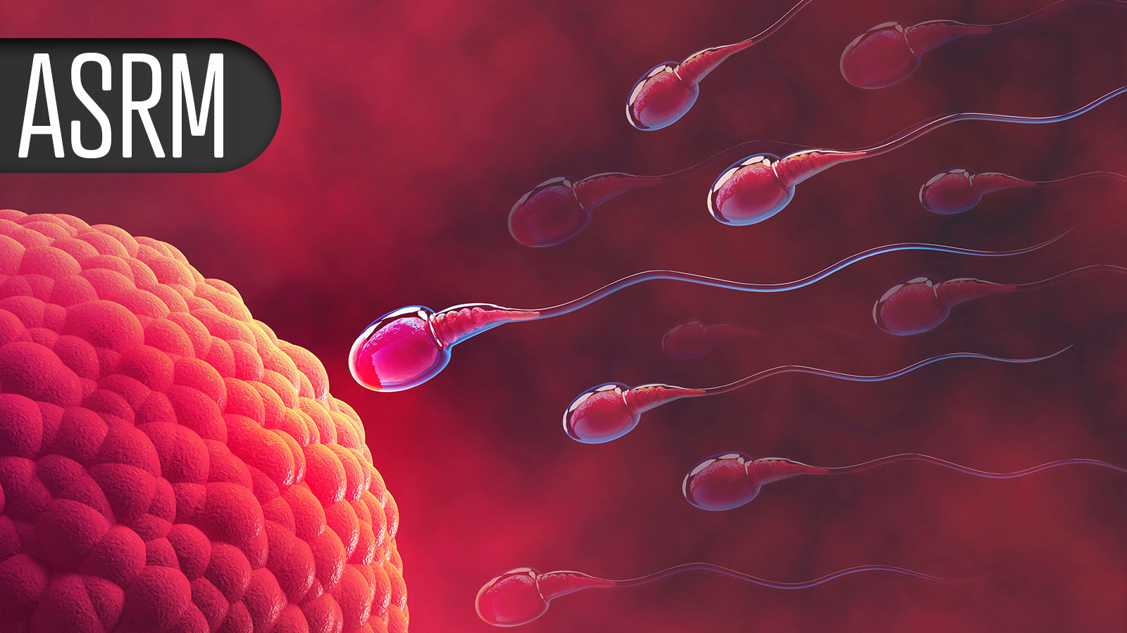 Couples Achieved Live Births Faster With IVF First