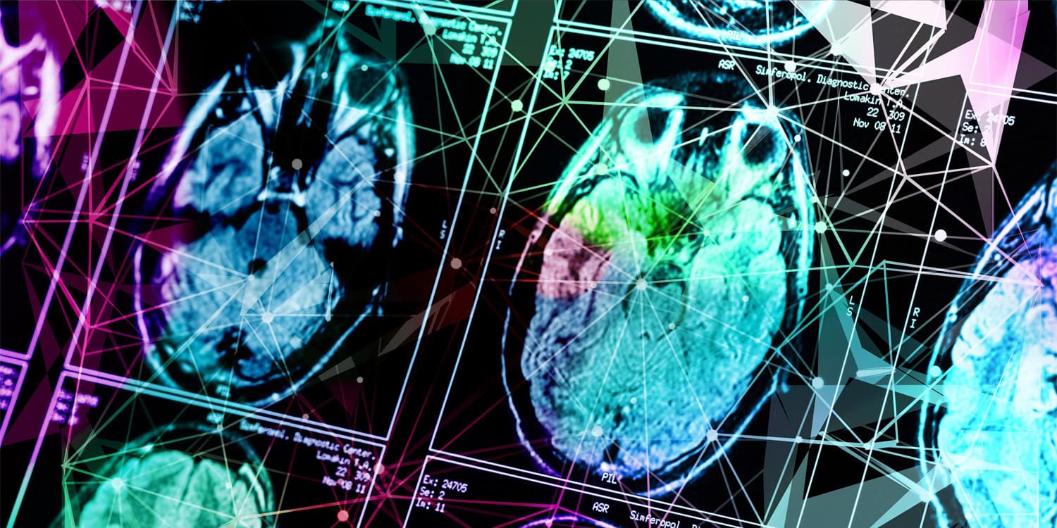Childhood abuse is linked to distinct brain differences depending on age, sex, and type of maltreatment