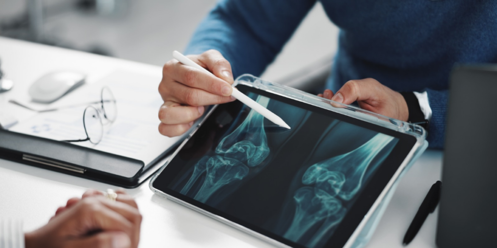 Taking osteoporosis medication in Spain? New safety update flags unusual fractures