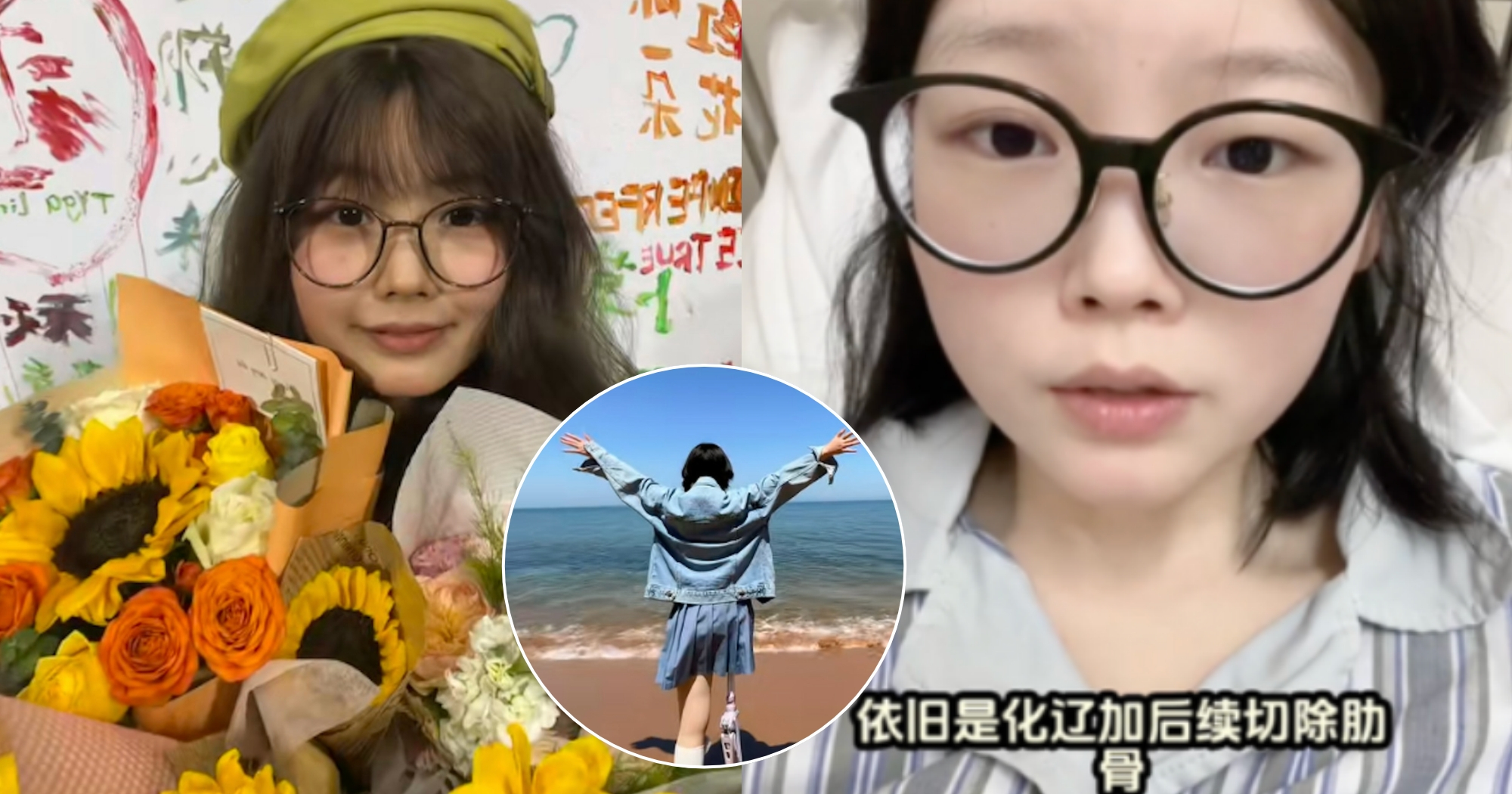 Chinese woman who stayed positive despite bone cancer, amputation & family abandonment, dies at 23