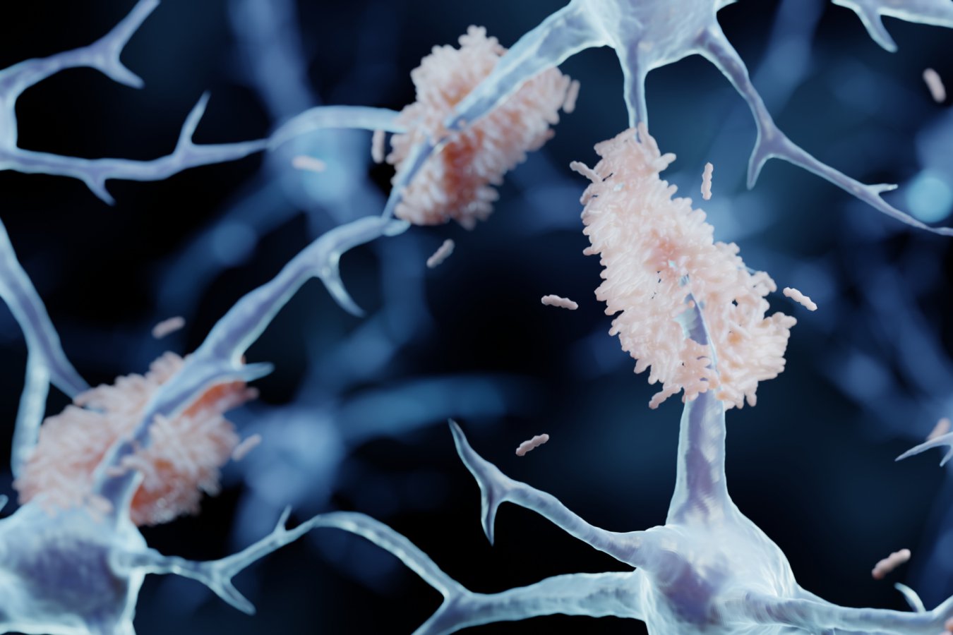 Thousands of people in China have had banned Alzheimer’s surgery