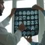 Pretrained AI could help clinics analyze brain MRIs with few labeled scans