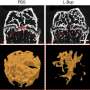 Targeting sensory nerves after growth plate injuries may bolster healing