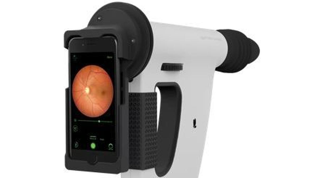 AI systems in smartphones may help detect eye diseases: study