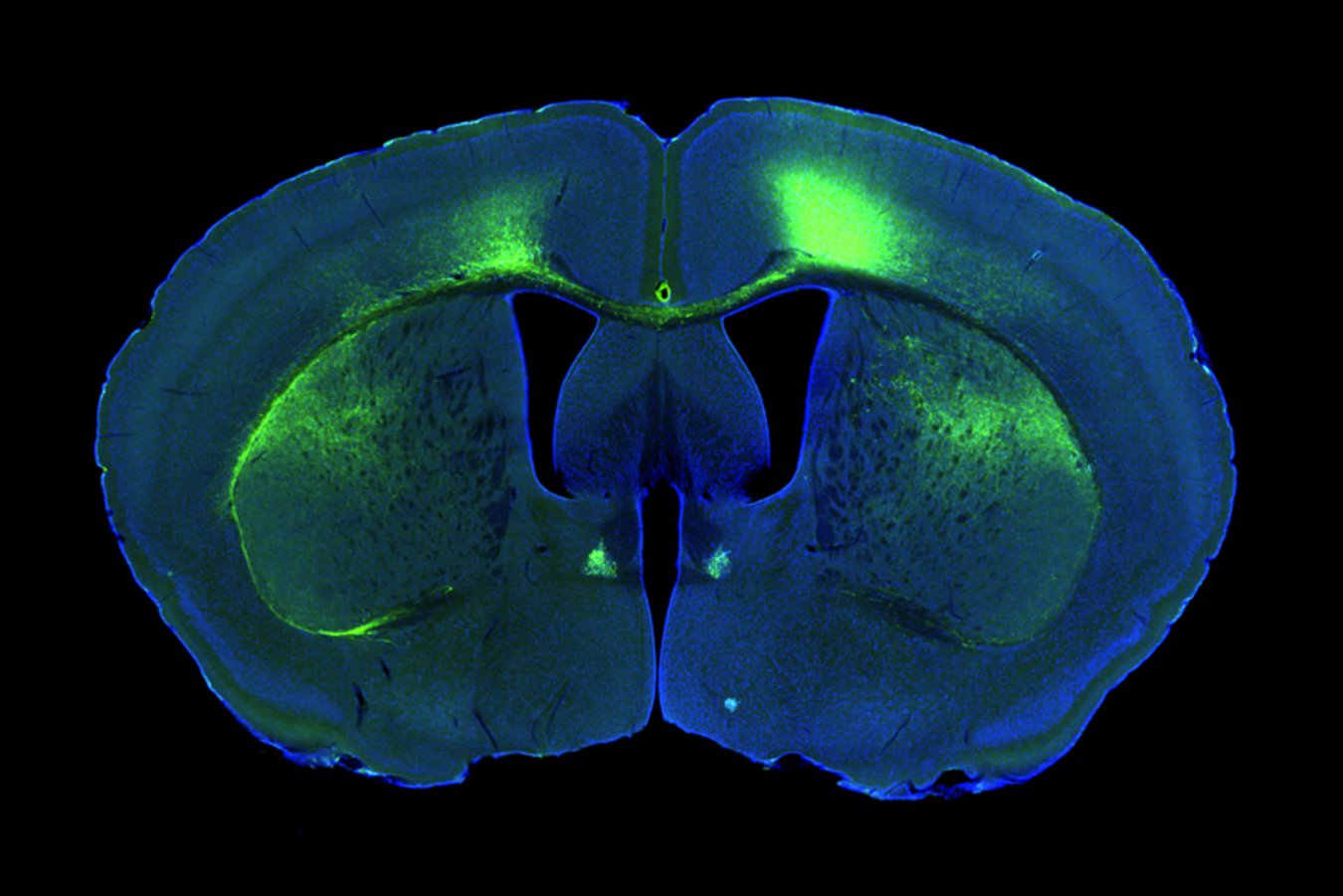 We may now know which neurons dictate when it is time to go to sleep