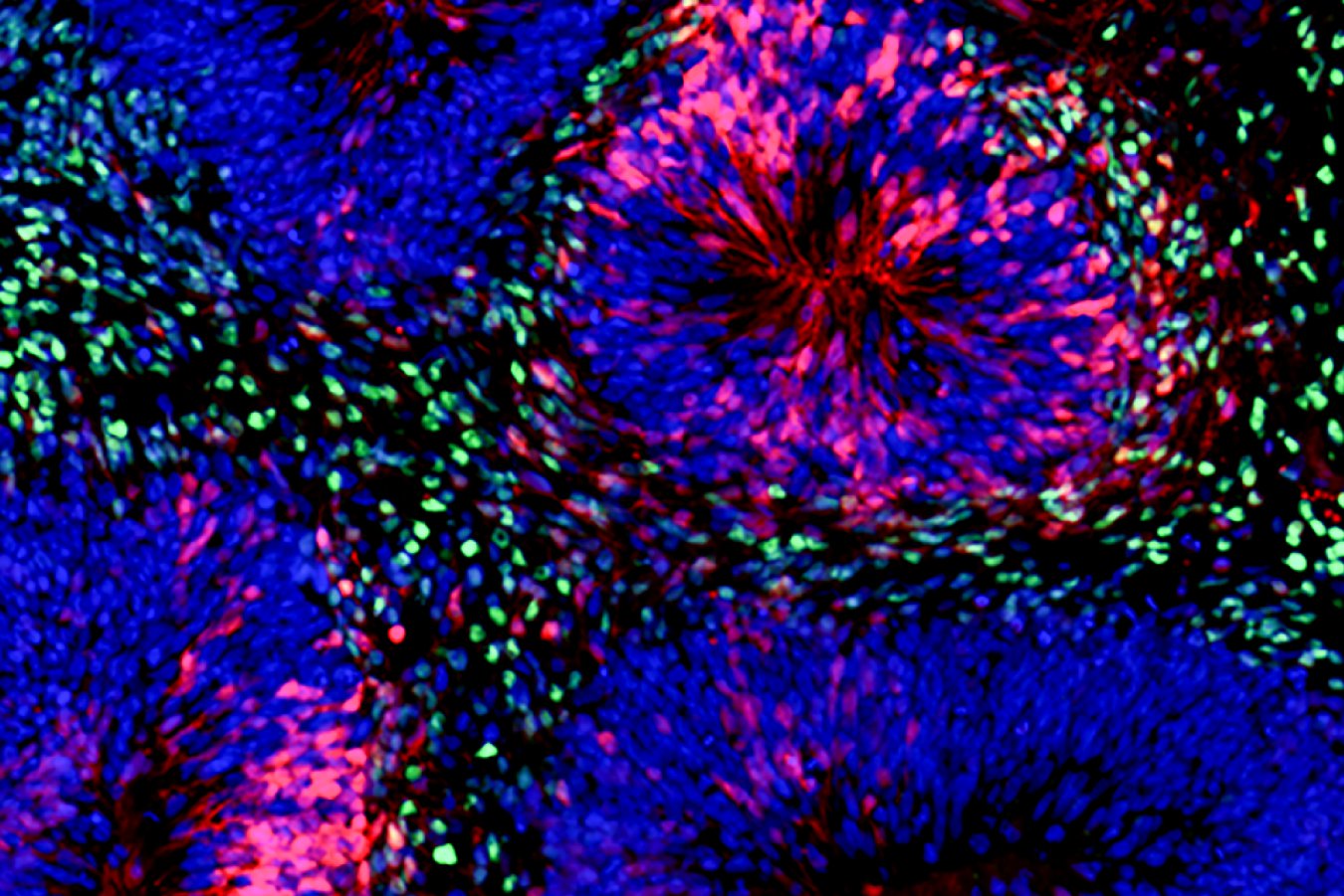 5-year-old brain organoids can sense the passing of time