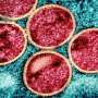 Guinea-Bissau faces first mpox outbreak: UNICEF