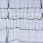 Closing the gap between suspecting a heart attack and confirming it