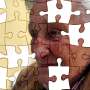 Microglia reveal distinct disease patterns in genetic and sporadic frontotemporal dementia