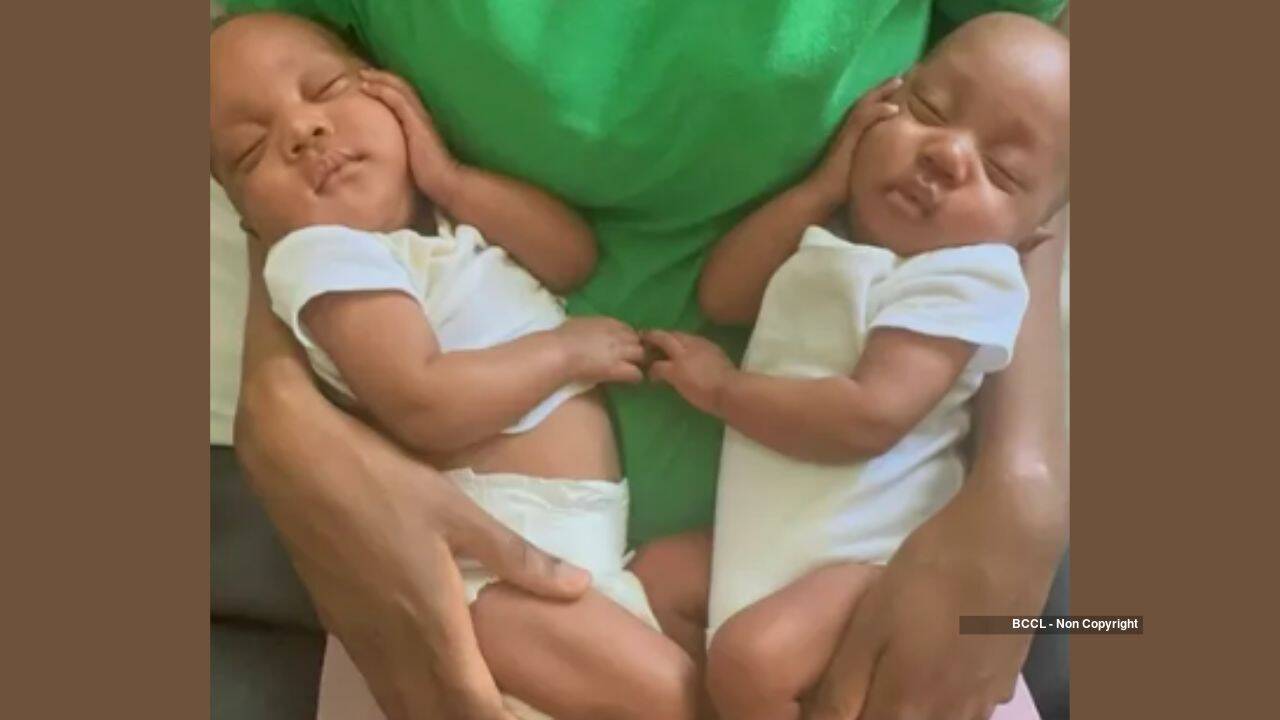 Rare twin girls born hugging finally go home after two months in intensive care
