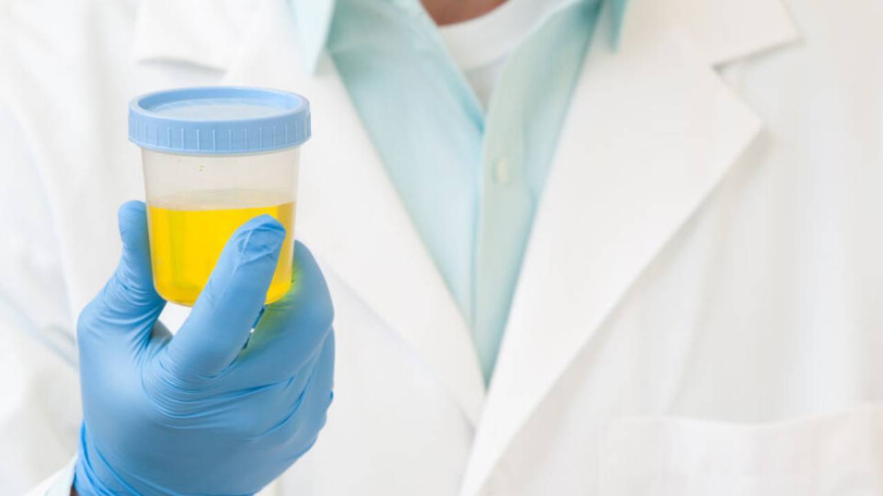 Scientists turn urine urea into hydrazine for rocket fuel and EV batteries