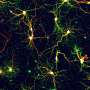 Atomic view of Alzheimer's disease peptide could inform new drugs
