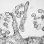 Hantavirus detected in France tourist now isolated in Spain