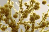 How a Deadly Superbug Tricks the Immune System to Survive in Hair Follicles