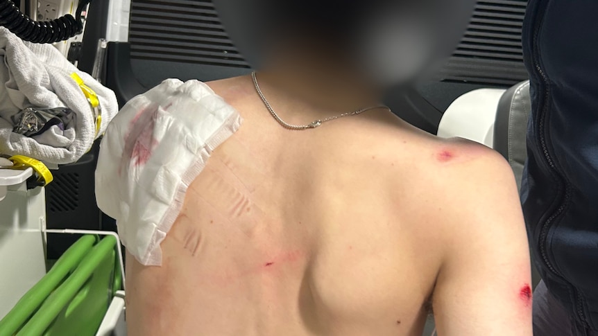 Police hunt pair over 'senseless' machete attack on teenager