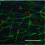 Injectable antioxidant hydrogel promotes retinal neuroprotection and visual recovery in mouse model
