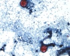 Is the cyclosporiasis outbreak slowing? Test-makers are hopeful