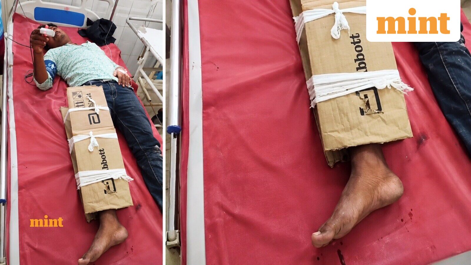 ‘Just bihar things’: Man with fractured leg gets cardboard support; social media reacts to viral video