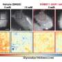 High glucose thickens cancer cells' sugar shield, helping them evade immune attack