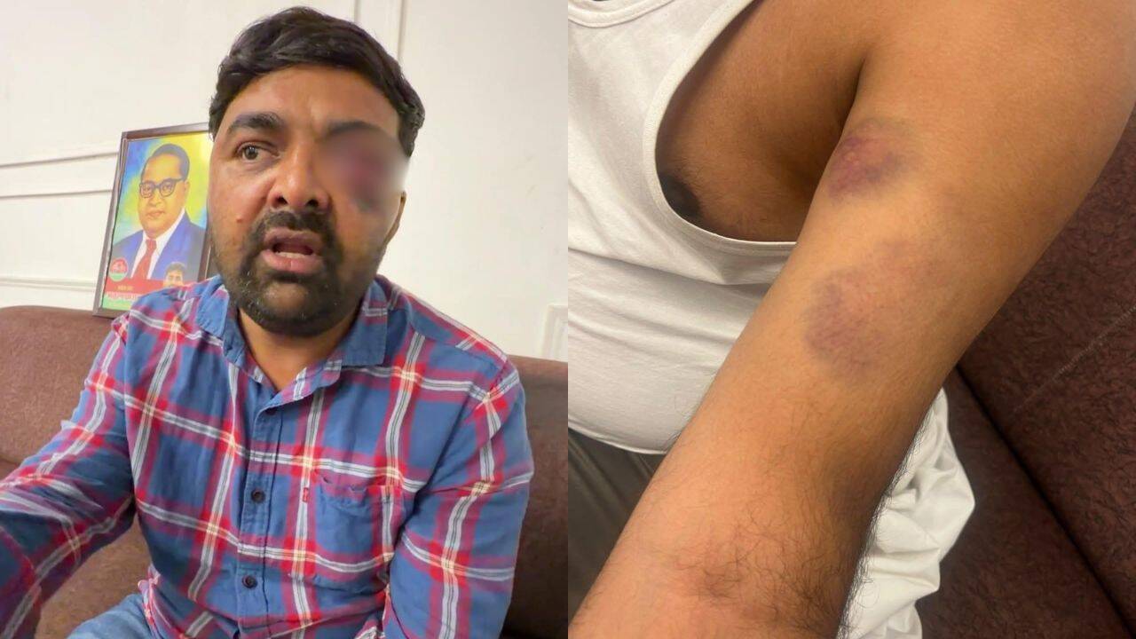 Meerut cops face action after ‘torture’ charge against farm leader, Dalit associate
