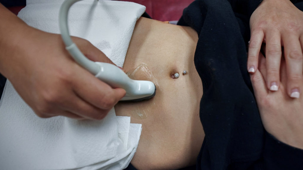 How state abortion bans are affecting doctors and how they practice