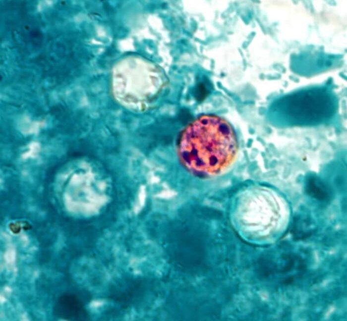 FDA reports new outbreak of explosive diarrhea with 72 cases identified