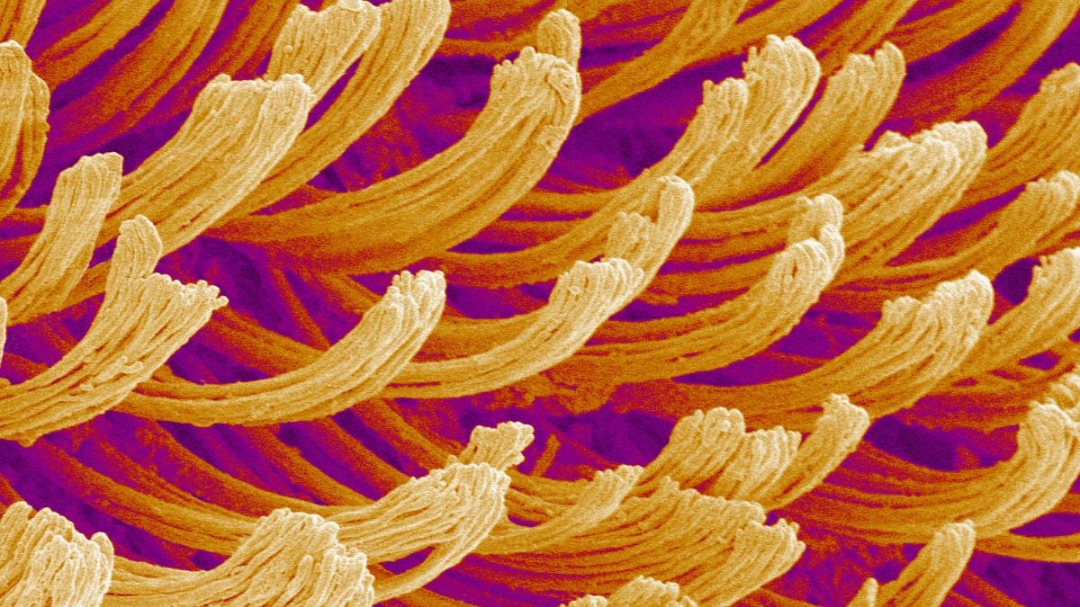 What The Heck Are We Looking at? This Week's Monday Microscope Mystery