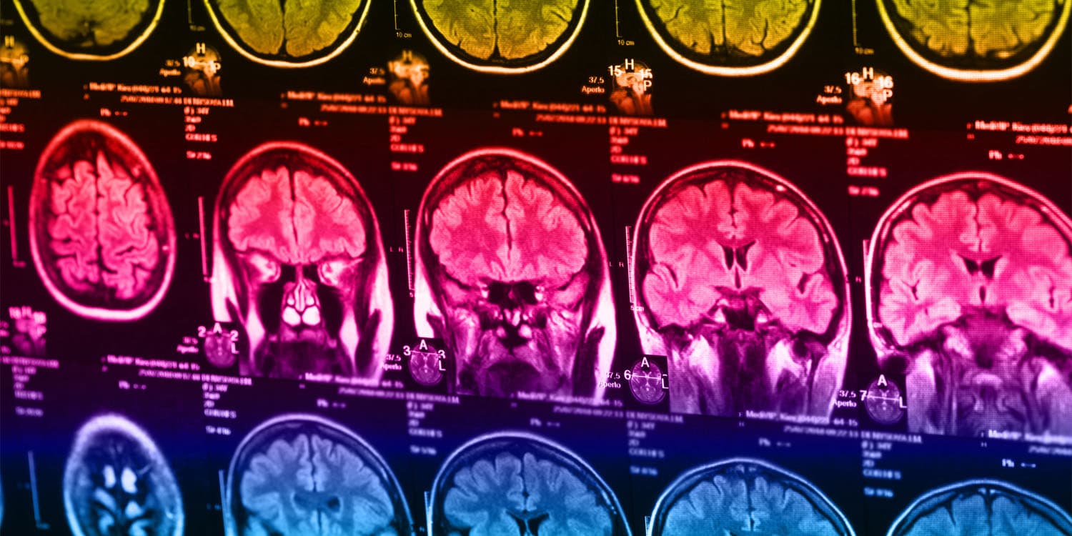 Different types of dementia are linked to unique inflammatory profiles, study suggests