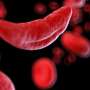 First-in-human pilot trial improves stem cell collection and delivery for sickle cell gene therapy