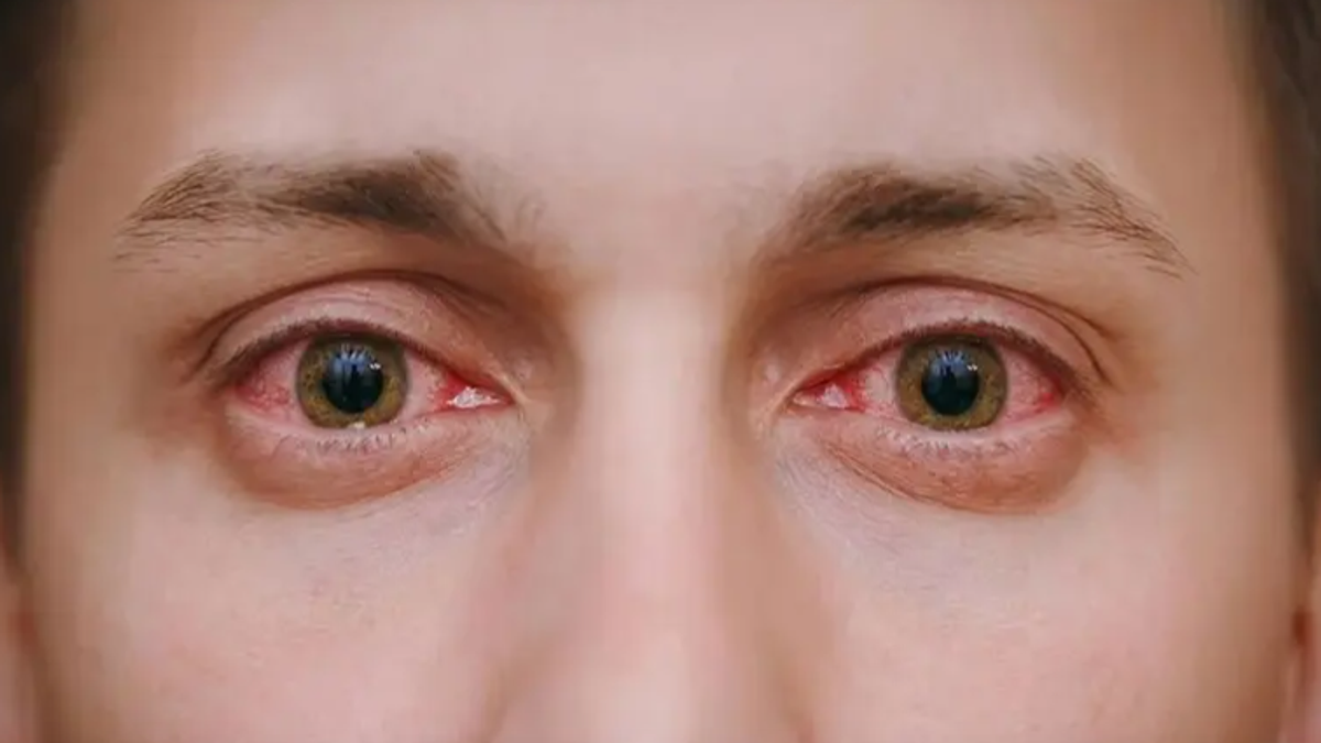 Three essential vitamins for eye health, says ophthalmologist