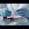 Ebola outbreak in DR Congo 'intensifying': WHO