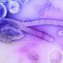 Egyptian group developing Ebola vaccine