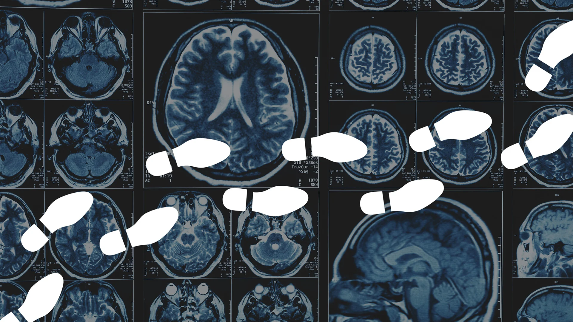 Think 10,000 Steps a Day Is the Magic Number for Brain Health? Research Suggests Otherwise