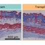 The anti-aging effects of exercise, without exercise: Self-contracting muscle implants give mice a boost