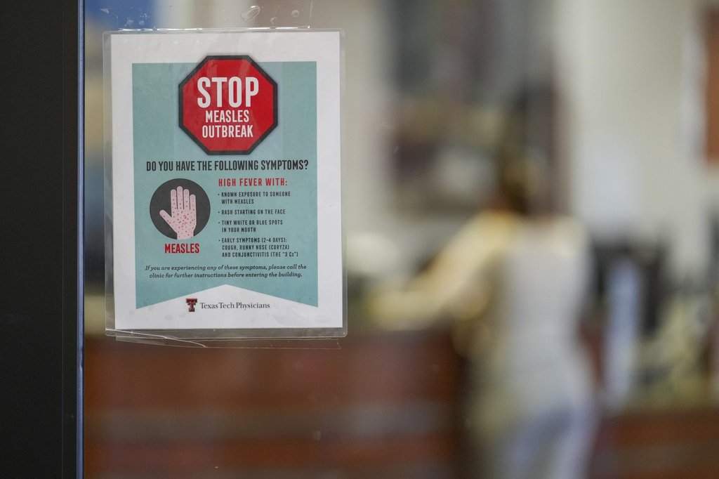 Canada’s measles cases are half of U.S. total, despite smaller population: WHO