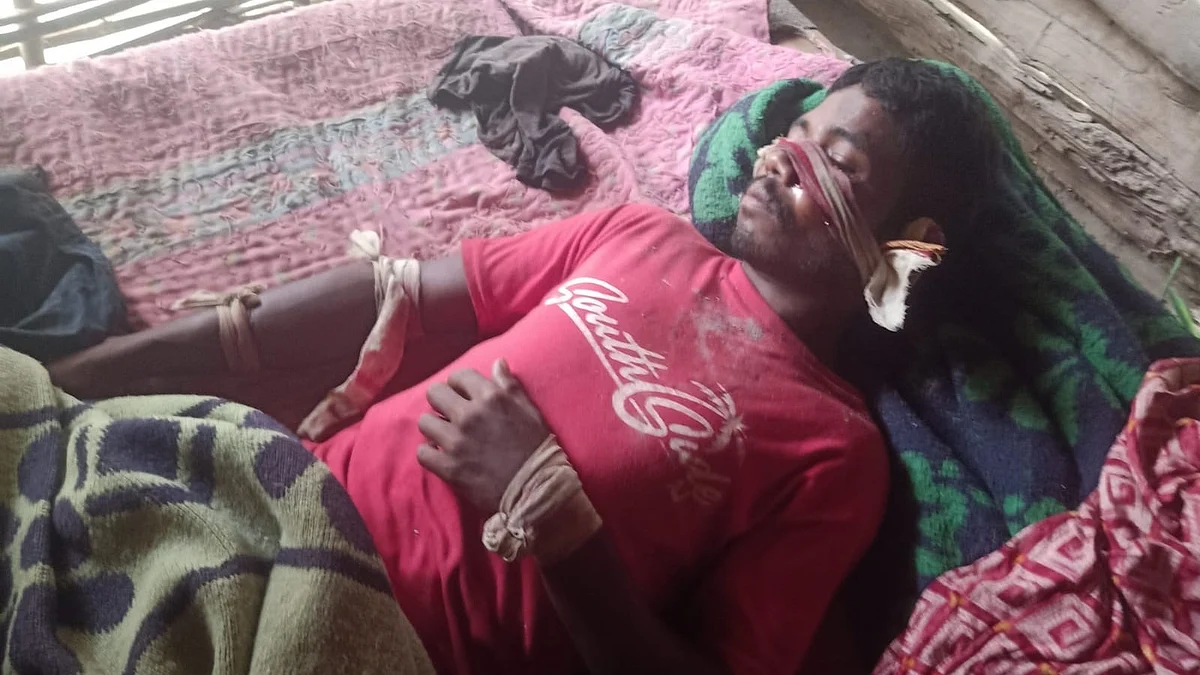 Tiger Attacks 35-Year-Old Man In Kanha Core Area, Condition Stable