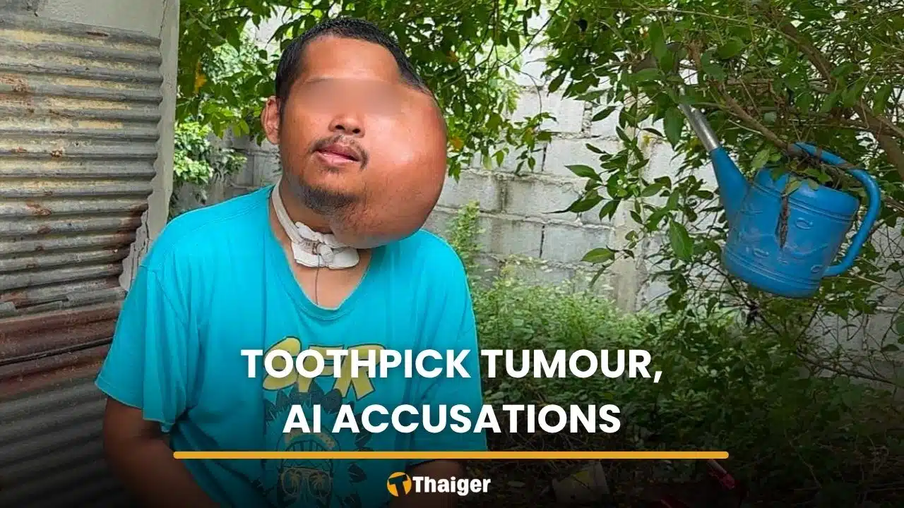 Tooth decay tumour leaves Thai man accused of faking photos