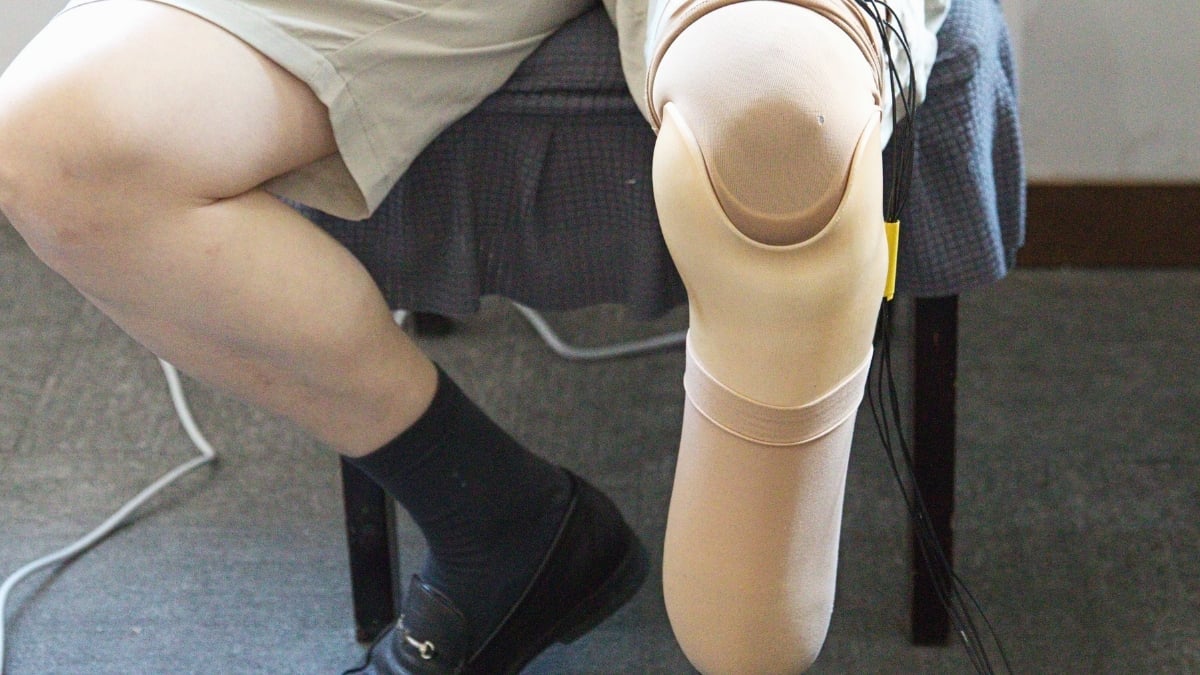Scientists Built Prosthetic 'Skin' That Mimics One Crucial Feature of Pain