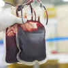 17.4 lakh blood components discarded in 2025 despite record collection