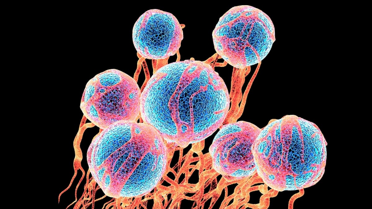 Common Sugar Appears to Loosen Cancer Cells And Help Them Spread